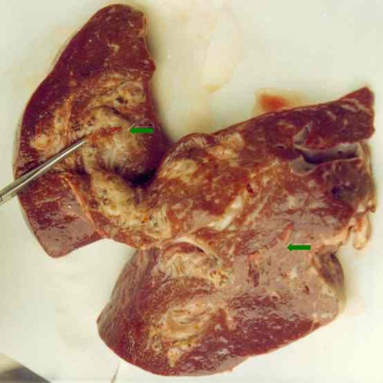 liver fluke , Fasciola hepatica