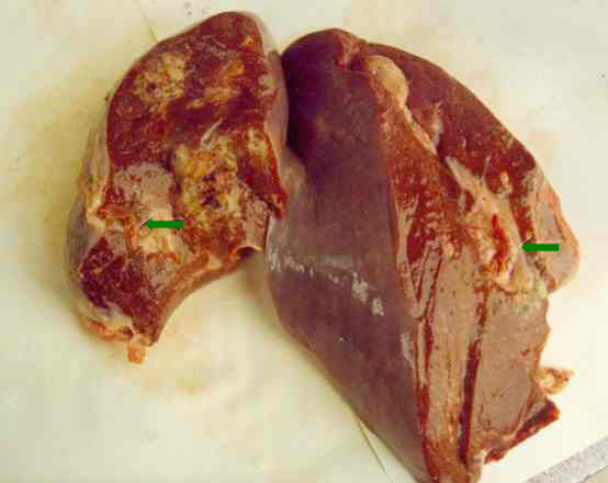 liver fluke , Fasciola hepatica